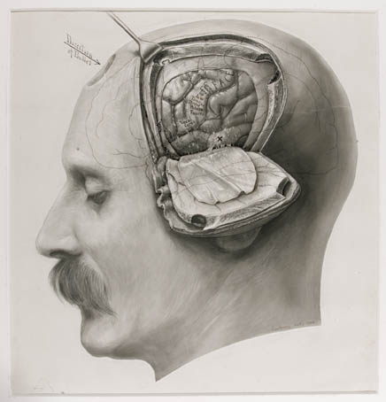 Drawing by Dr. Harvey Cushing, early 20th Century